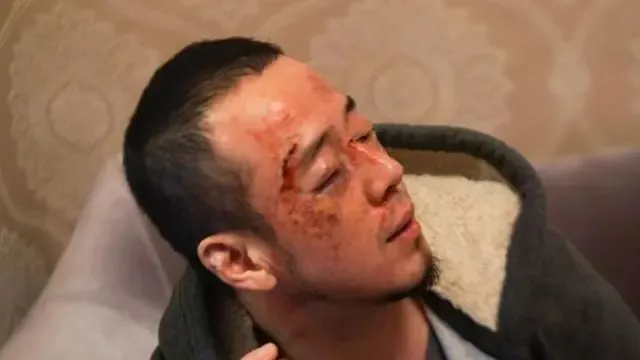警方回应“杨坤在长沙演出结束后返回酒店途中被打”传闻